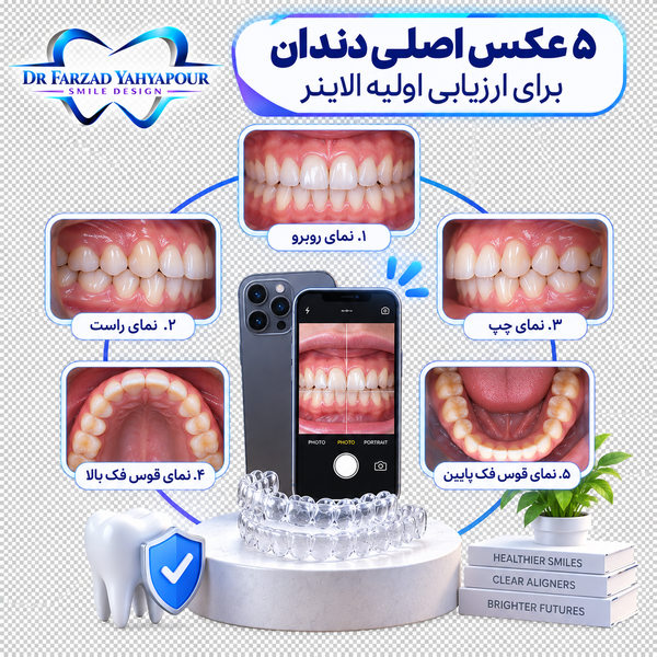 ۵ عکس اصلی برای بررسی اولیه الاینر
